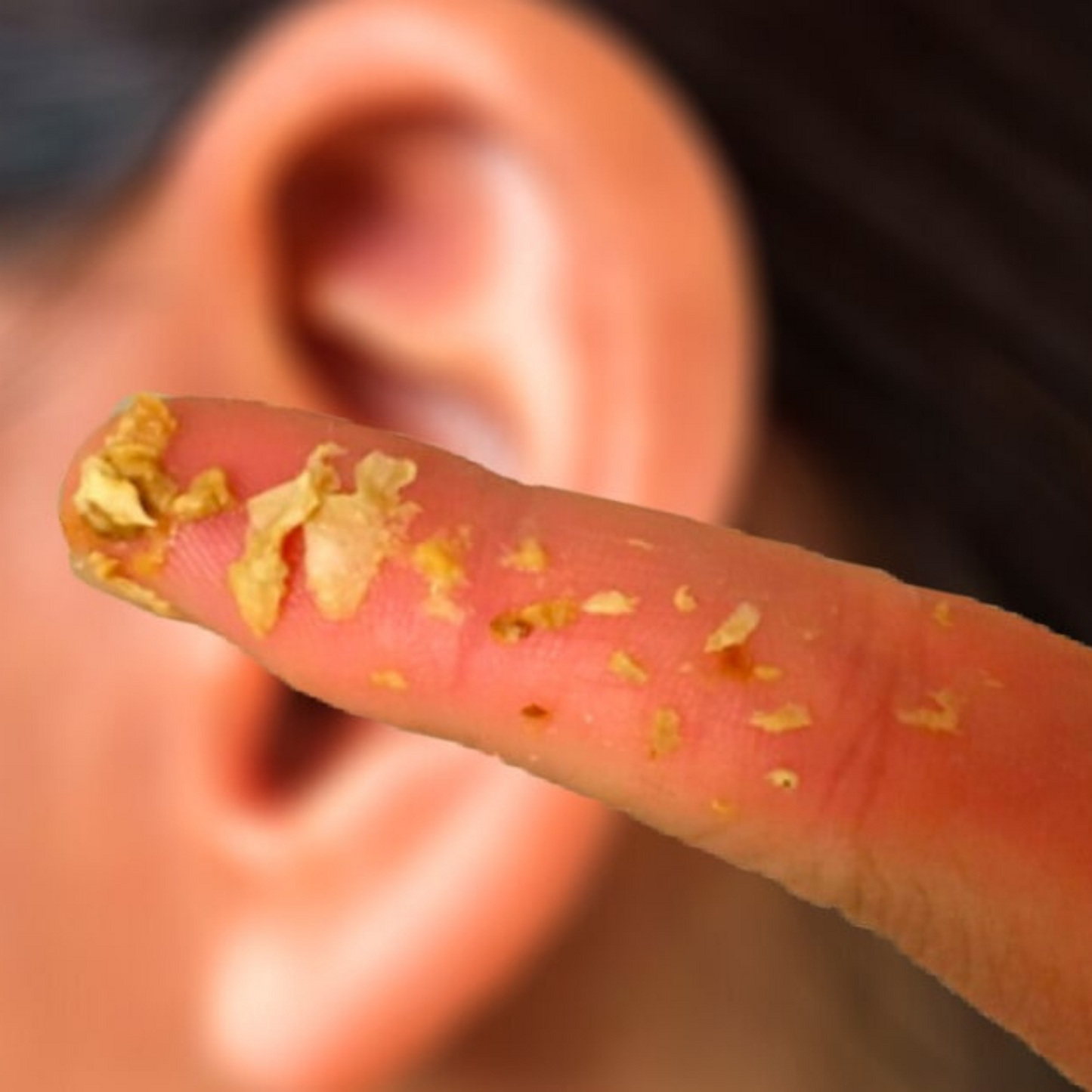 The Original Ear Cleaner - Qgrips