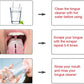 Tongue Cleaner
